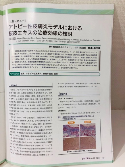 10302215_52710675591e1